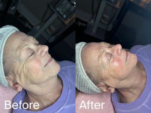 compress 20240109 231349