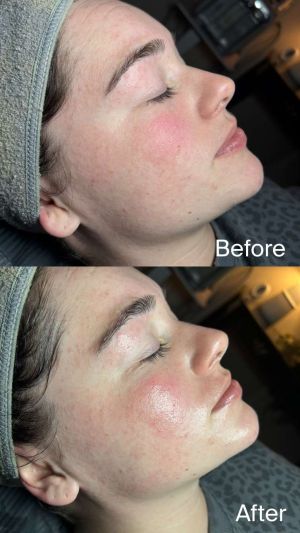 compress 20240109 231349