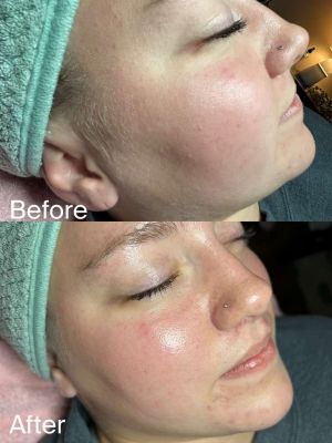 compress 20240109 231350